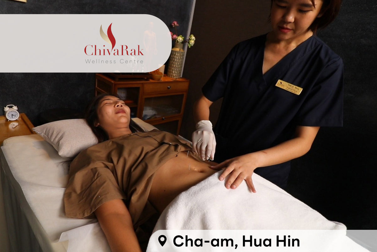 Chinese Acupuncture 60 mins Hua Hin