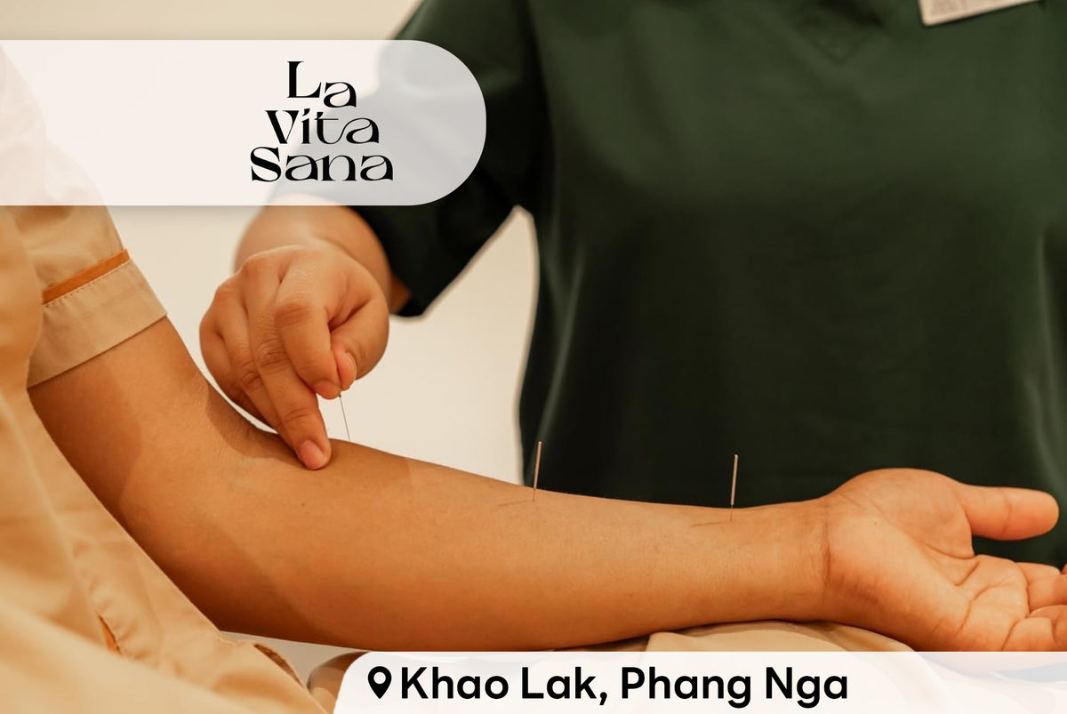 CHINESE ACUPUNCTURE (60 mins) La Vita Sana – B-Healthy