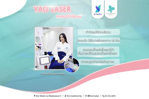 Laser YAG
