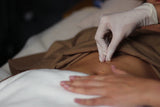 ACUPUNCTURE FOR BODY SHAPE
