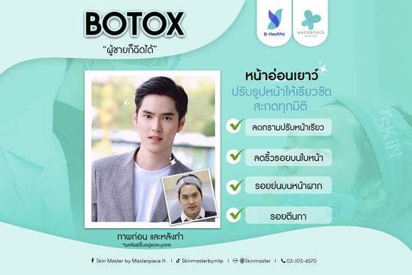 Botox (Dysport | Aestox)