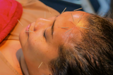 Facial Acupuncture & Mask (60 Mins)