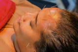 Facial Acupuncture (45 นาที)