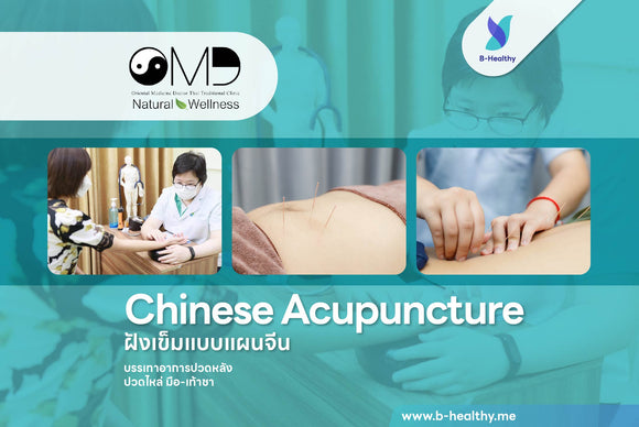 Chineses Acupuncture (60 Mins)